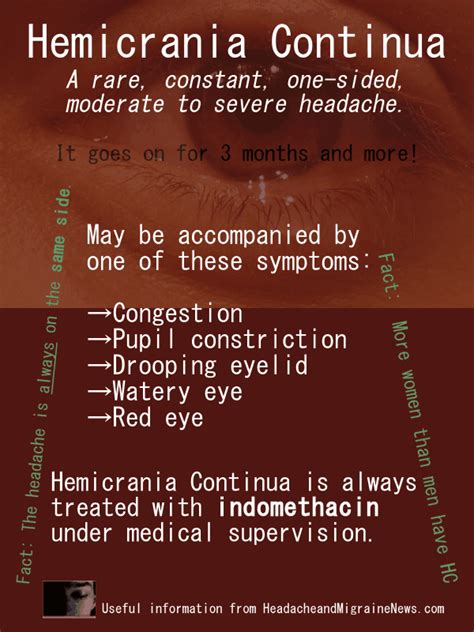 Hemicrania Continua Facts - Headache and Migraine News