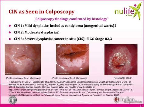 Nulife module 6 screening for malignancies edited