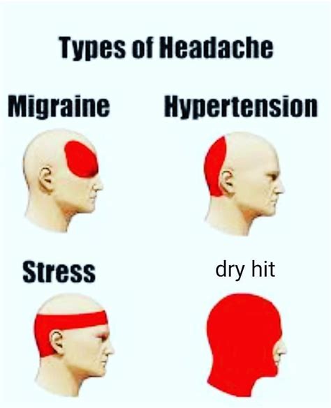 Headache Meme Template