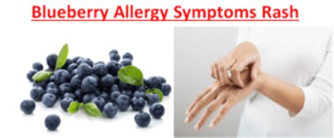 Blueberry Allergy Symptoms, Should we avoid? - Fruits Facts