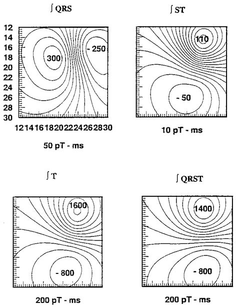 Simulated iso-integral magnetic field maps for a normal heart. Values... | Download Scientific ...