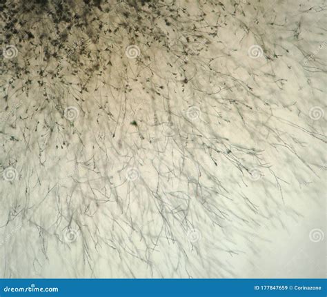 Aspergillus Fumigatus Under The Microscope Royalty-Free Stock Photo ...