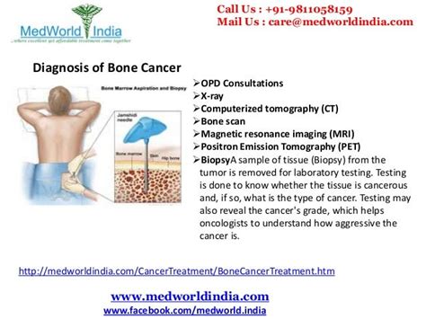 Best Cancer Hospitals of India for Advanced Bone Cancer Treatment
