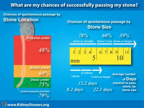 What are my chances of successfully passing my stone?- A KidneyStoners.org Infographic