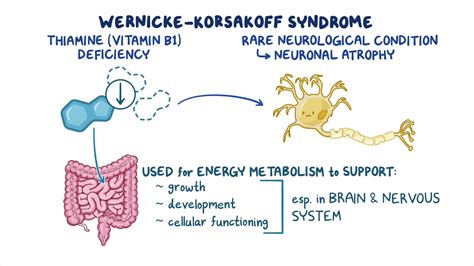 Wernicke-Korsakoff syndrome: Year of the Zebra: Video | Osmosis