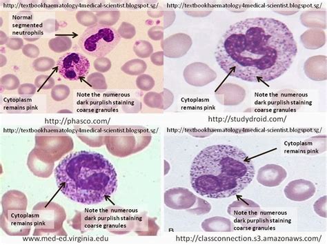 Vacuolated Neutrophils Toxic images