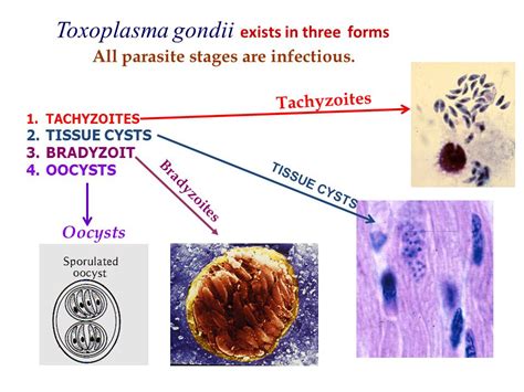 What is toxoplasmosis gondii