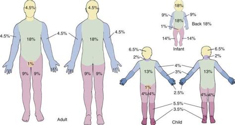 Rule Of Nines Diagram - Wiring Diagram