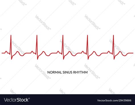 Ecg heartbeat line electrocardiogram normal Vector Image