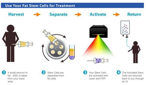 Why Do We Side With Stem-Cell Therapy? – Global Stem Cells Group