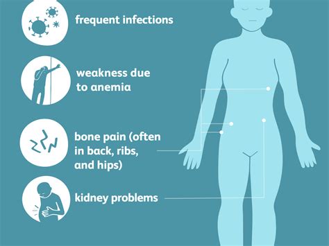 Multiple Myeloma -Symptoms, Causes, Risk Factors & Complications