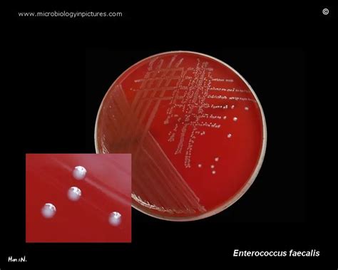 Enterococcus Faecalis Gram Stain