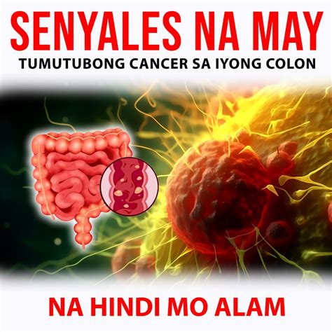 Maagang Senyales ng Kanser sa Colon! | Mga Senyales na may Tumutubong Kanser sa Colon mo! | By ...