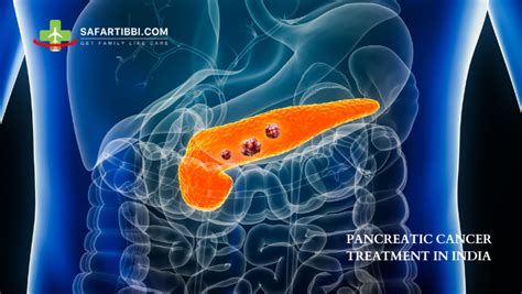 Pancreatic Cancer Treatment in India: Costs and Options