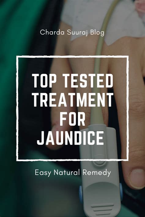 Top Tested Treatment for Jaundice (Hepatitis A) - Charda Suuraj