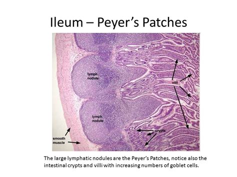 Histology Of Ileum Peyers Patches