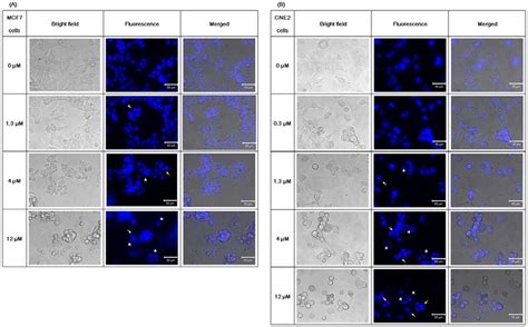 Hoechst 33342 staining. Fluorescence microscope images on Hoechst 33342... | Download Scientific ...