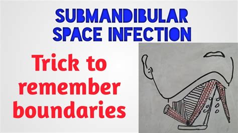 Submandibular space infection - trick to remember boundaries - YouTube