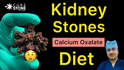 Diet in case of Calcium Oxalate Kidney stones? | Calcium Oxalate Diet मैं क्या खाएं #kidneystone ...