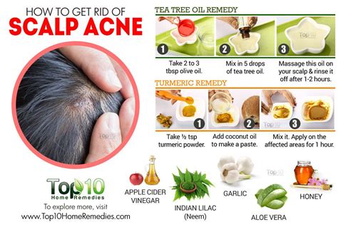 cystic acne on scalp - pictures, photos