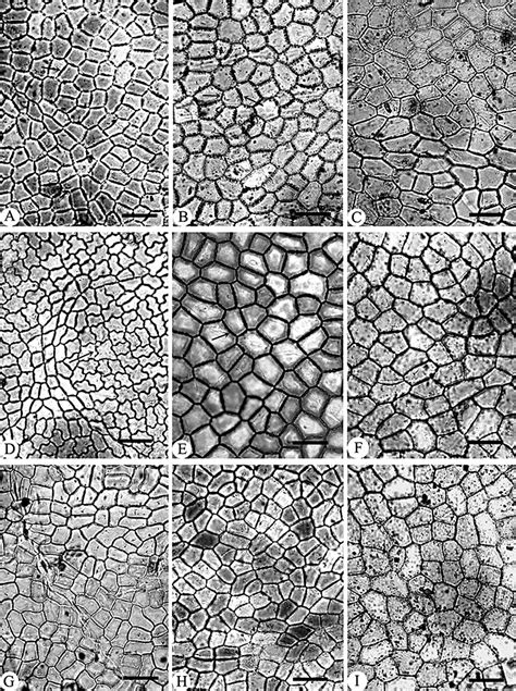 Characteristics of the adaxial epidermal cells (light microscopy) in ...