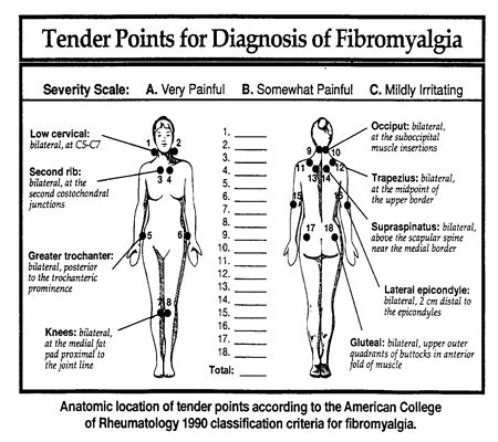 Fibromyalgia Treatment in Houston - Houston Walk In Chiropractic