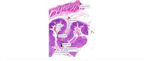 Stomach Pylorus Histology Slide, For TEACHING in MEDICAL COLLEGES, Thickness: 1.2mm at Rs 500 ...