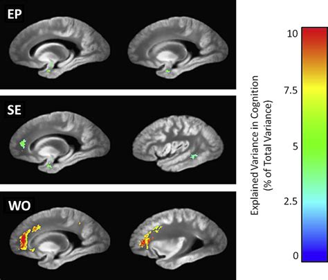 Sagittal views of the regions in which episodic memory (EP), semantic ...