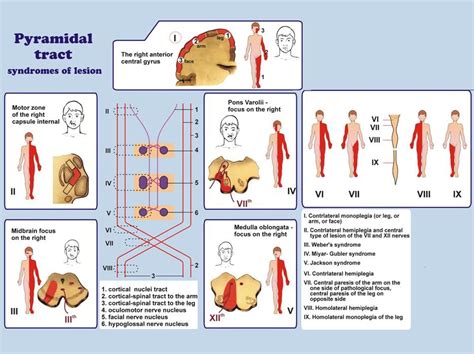 Pyramidal