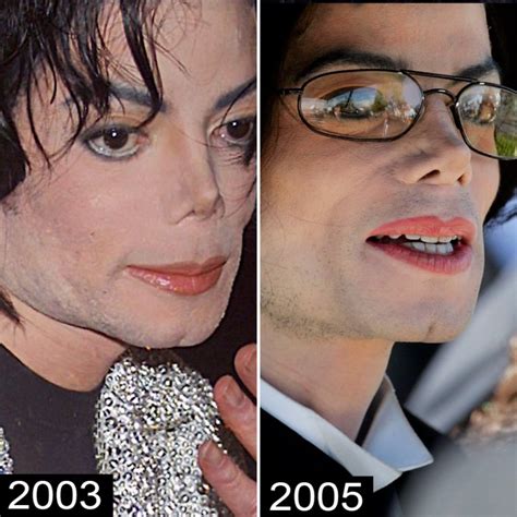 Michael Jackson's Plastic Surgery — See His Transformation