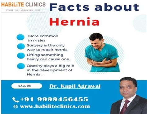 Best hernia surgeon in delhi 1 by Habilite1234 on DeviantArt