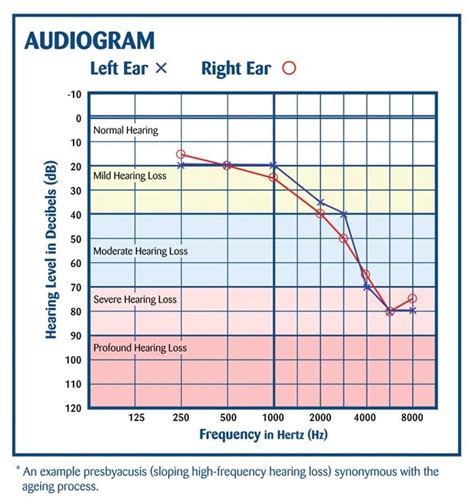 Audiology Diagnostic Assessment - City Hearing – Audiology Services