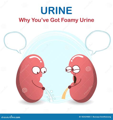 Sign and Symptom of Kidney Disease, Bad Health. Urine Has Many Foamy or Bubble, this Sign of a ...