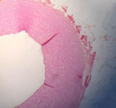 Vessels Histology - Aorta - histology slide