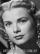 Grace Kelly | Before and After | Photos, Biography and Family