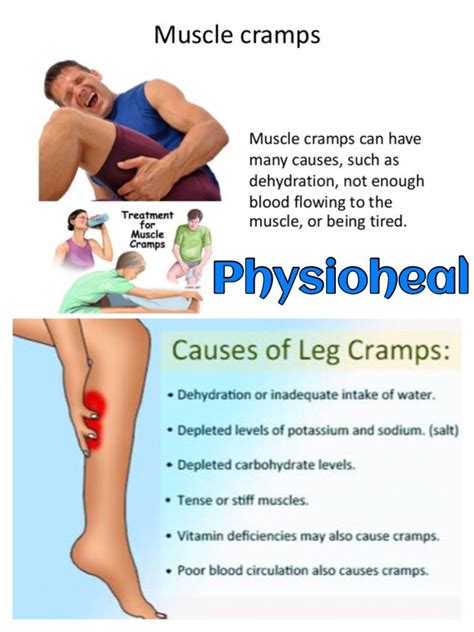 Leg Cramps at night ! Anyone? - PhysioHeal