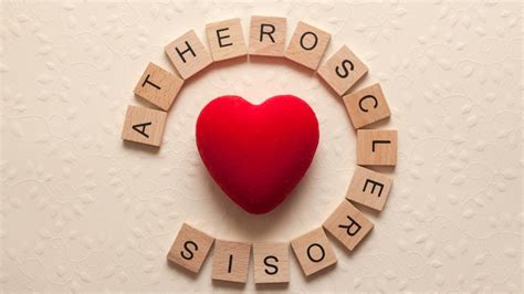 Atherosclerosis: Causes, Symptoms, Treatment And Prevention