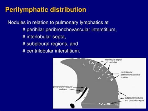 Technical aspect of hrct; normal lung anatomy & hrct findings of lung…