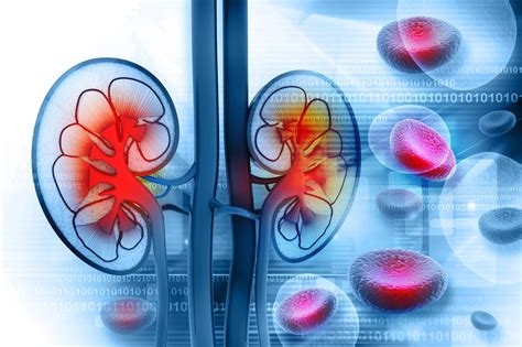 Advanced Kidney Disease Common at Presentation With ANCA-Associated ...