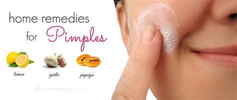 29 Natural Home Remedies for Pimples on Back, Face & Others