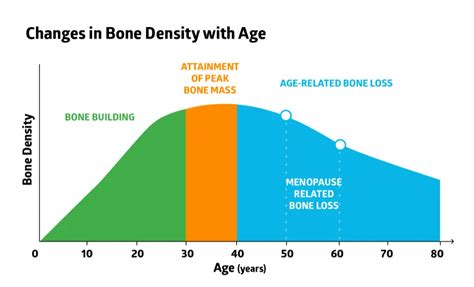 Osteoporosis Treatment - Naturally Increase Bone Density | AlgaeCal