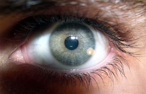 File:Brown human eye (2).jpg - Wikimedia Commons