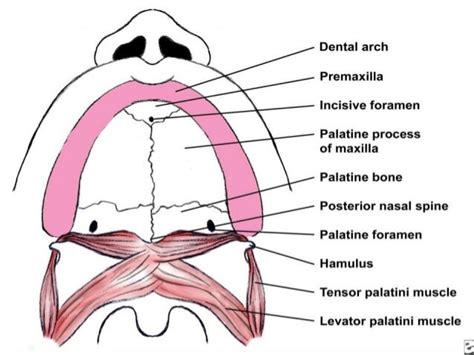 Cleft lip and Cleft palate embryology, features, and management