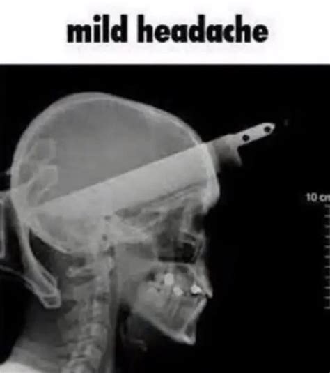 Mild Headache : r/Rex_Memes