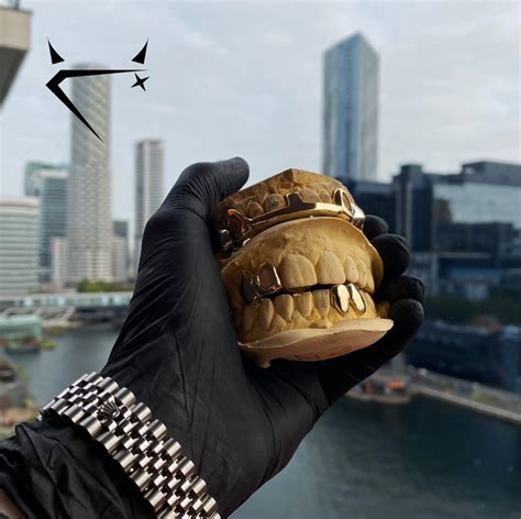 Custom Dental Yellow Gold Grillz - Etsy