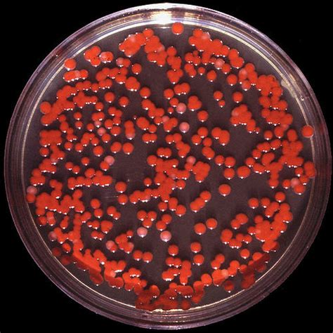 Serratia – MRSA Today