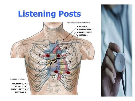 Heart Sounds And Murmurs