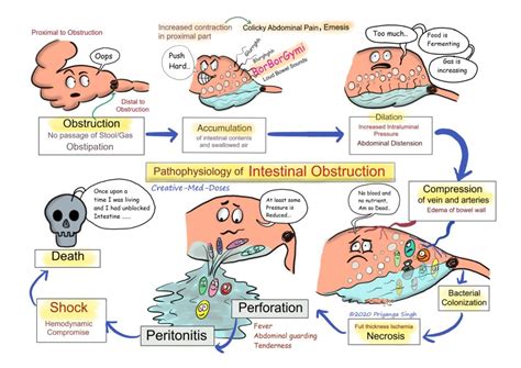 Acute intestinal obstruction: Pathophysiology - Creative Med Doses