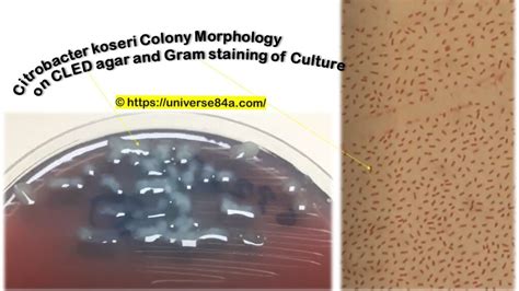 Citrobacter koseri: Introduction, Morphology, Pathogenicity, Lab