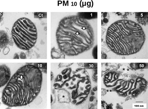 Mitochondria Electron Microscope